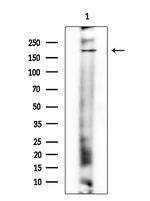 Phospho-TOP2A (Ser1469) Antibody in Western Blot (WB)