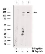 Phospho-ULK1 (Ser467) Antibody in Western Blot (WB)