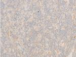 Phospho-IkappaB epsilon (Ser161) Antibody in Immunohistochemistry (Paraffin) (IHC (P))