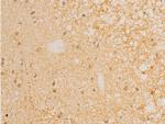 Phospho-IkappaB epsilon (Ser161) Antibody in Immunohistochemistry (Paraffin) (IHC (P))