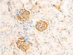 Phospho-IkappaB epsilon (Ser161) Antibody in Immunohistochemistry (Paraffin) (IHC (P))