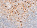 Phospho-IkappaB epsilon (Ser161) Antibody in Immunohistochemistry (Paraffin) (IHC (P))