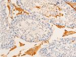 Phospho-IkappaB epsilon (Ser161) Antibody in Immunohistochemistry (Paraffin) (IHC (P))