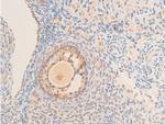 Phospho-IkappaB epsilon (Ser161) Antibody in Immunohistochemistry (Paraffin) (IHC (P))