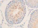 Phospho-IkappaB epsilon (Ser161) Antibody in Immunohistochemistry (Paraffin) (IHC (P))