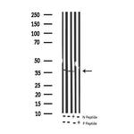 Phospho-IkappaB epsilon (Ser161) Antibody in Western Blot (WB)