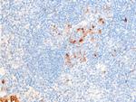 Phospho-Chk1 (Ser286) Antibody in Immunohistochemistry (Paraffin) (IHC (P))