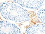 Phospho-Chk1 (Ser286) Antibody in Immunohistochemistry (Paraffin) (IHC (P))