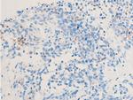 Phospho-Chk1 (Ser286) Antibody in Immunohistochemistry (Paraffin) (IHC (P))