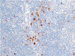 Phospho-Chk1 (Ser301) Antibody in Immunohistochemistry (Paraffin) (IHC (P))