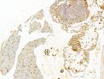 Phospho-IKK beta (Tyr199) Antibody in Immunohistochemistry (Paraffin) (IHC (P))