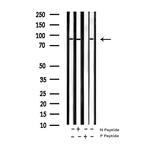 Phospho-IKK beta (Tyr199) Antibody in Western Blot (WB)