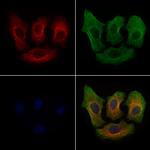 Phospho-IKK alpha (Thr23) Antibody in Immunocytochemistry (ICC/IF)