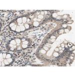 Phospho-IKK alpha (Thr23) Antibody in Immunohistochemistry (Paraffin) (IHC (P))