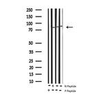 Phospho-IKK alpha (Thr23) Antibody in Western Blot (WB)