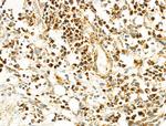 Phospho-IKK alpha/beta (Ser180, Ser181) Antibody in Immunohistochemistry (Paraffin) (IHC (P))