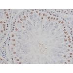 Phospho-IKK alpha/beta (Ser180, Ser181) Antibody in Immunohistochemistry (Paraffin) (IHC (P))