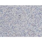 Phospho-IKK alpha/beta (Ser180, Ser181) Antibody in Immunohistochemistry (Paraffin) (IHC (P))