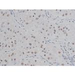 Phospho-IKK alpha/beta (Ser180, Ser181) Antibody in Immunohistochemistry (Paraffin) (IHC (P))