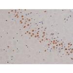 Phospho-IKK alpha/beta (Ser180, Ser181) Antibody in Immunohistochemistry (Paraffin) (IHC (P))