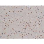 Phospho-IKK alpha/beta (Ser180, Ser181) Antibody in Immunohistochemistry (Paraffin) (IHC (P))