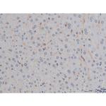 Phospho-IKK alpha/beta (Ser180, Ser181) Antibody in Immunohistochemistry (Paraffin) (IHC (P))