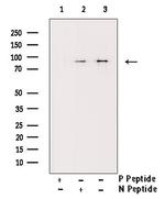 Phospho-IKK alpha/beta (Ser180, Ser181) Antibody in Western Blot (WB)