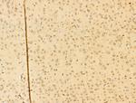 Phospho-IKK alpha/beta (Ser176, Ser177) Antibody in Immunohistochemistry (Paraffin) (IHC (P))