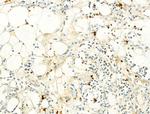 Phospho-IKK alpha/beta (Ser176, Ser177) Antibody in Immunohistochemistry (Paraffin) (IHC (P))