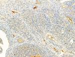 Phospho-IKK alpha/beta (Ser176, Ser177) Antibody in Immunohistochemistry (Paraffin) (IHC (P))