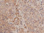 Phospho-IKK alpha/beta (Ser176, Ser177) Antibody in Immunohistochemistry (Paraffin) (IHC (P))