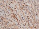 Phospho-IKK alpha/beta (Ser176, Ser177) Antibody in Immunohistochemistry (Paraffin) (IHC (P))