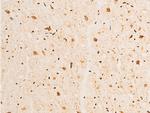 Phospho-p73 (Tyr99) Antibody in Immunohistochemistry (Paraffin) (IHC (P))