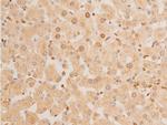 Phospho-p73 (Tyr99) Antibody in Immunohistochemistry (Paraffin) (IHC (P))