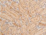 Phospho-p73 (Tyr99) Antibody in Immunohistochemistry (Paraffin) (IHC (P))