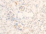 Phospho-Survivin (Thr117) Antibody in Immunohistochemistry (Paraffin) (IHC (P))