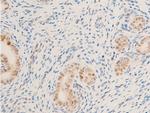 Phospho-Survivin (Thr117) Antibody in Immunohistochemistry (Paraffin) (IHC (P))