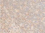 Phospho-PDPK1 (Ser241) Antibody in Immunohistochemistry (Paraffin) (IHC (P))