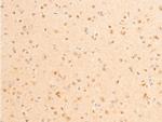 Phospho-PDPK1 (Ser241) Antibody in Immunohistochemistry (Paraffin) (IHC (P))