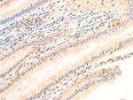 Phospho-PDPK1 (Ser241) Antibody in Immunohistochemistry (Paraffin) (IHC (P))