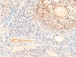 Phospho-PDPK1 (Ser241) Antibody in Immunohistochemistry (Paraffin) (IHC (P))