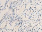 Phospho-MiTF (Ser180) Antibody in Immunohistochemistry (Paraffin) (IHC (P))