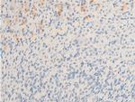 Phospho-MiTF (Ser180) Antibody in Immunohistochemistry (Paraffin) (IHC (P))