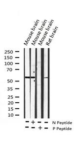 Phospho-DAB1 (Tyr232) Antibody in Western Blot (WB)