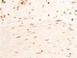 Phospho-Chk2 (Thr383) Antibody in Immunohistochemistry (Paraffin) (IHC (P))