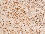 Phospho-Chk2 (Thr383) Antibody in Immunohistochemistry (Paraffin) (IHC (P))