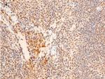 Phospho-Chk2 (Thr383) Antibody in Immunohistochemistry (Paraffin) (IHC (P))