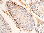 Phospho-Chk2 (Thr383) Antibody in Immunohistochemistry (Paraffin) (IHC (P))