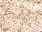 Phospho-Chk2 (Thr383) Antibody in Immunohistochemistry (Paraffin) (IHC (P))