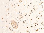 Phospho-Chk2 (Thr68) Antibody in Immunohistochemistry (Paraffin) (IHC (P))